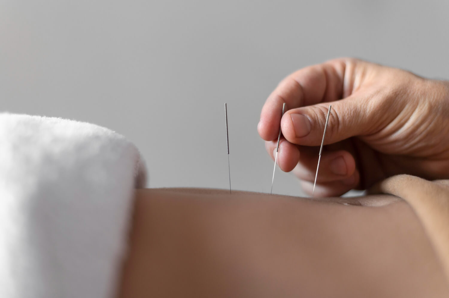 Cupping Therapy VS Massage
