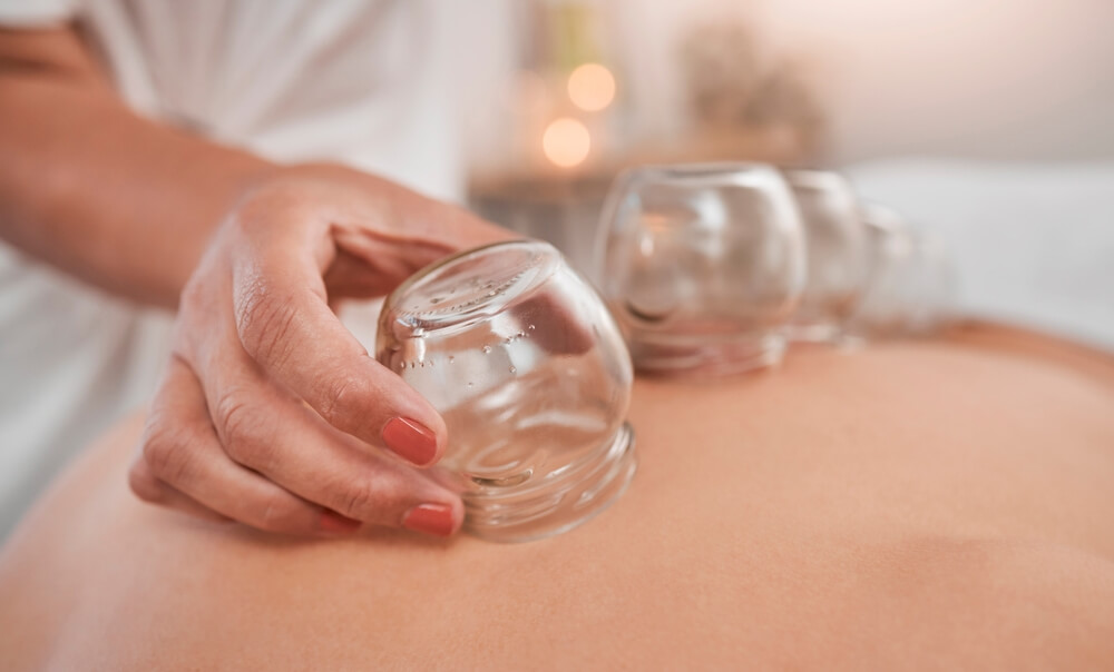 Cupping Therapy VS Massage