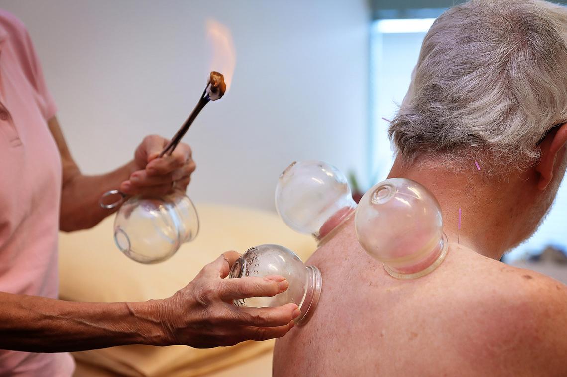 Therapist performing traditional cupping therapy on a man's shoulder
